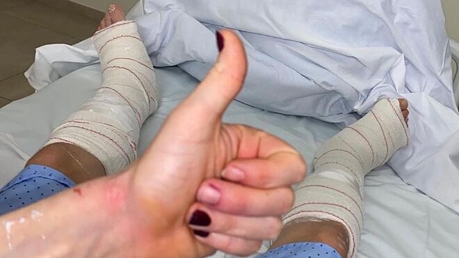Imagen de sus tobillos lesionados, difundida por Ana Pérez en su cuenta de una red social