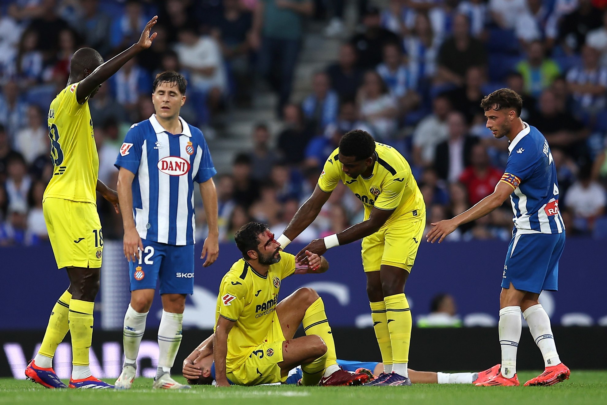 Albiol, sangrando tras el golpe.