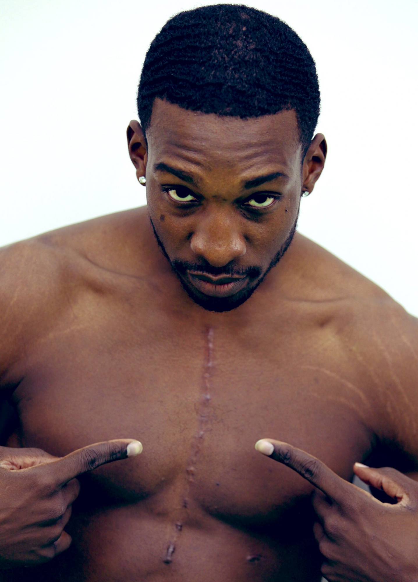 Green, with his scar.