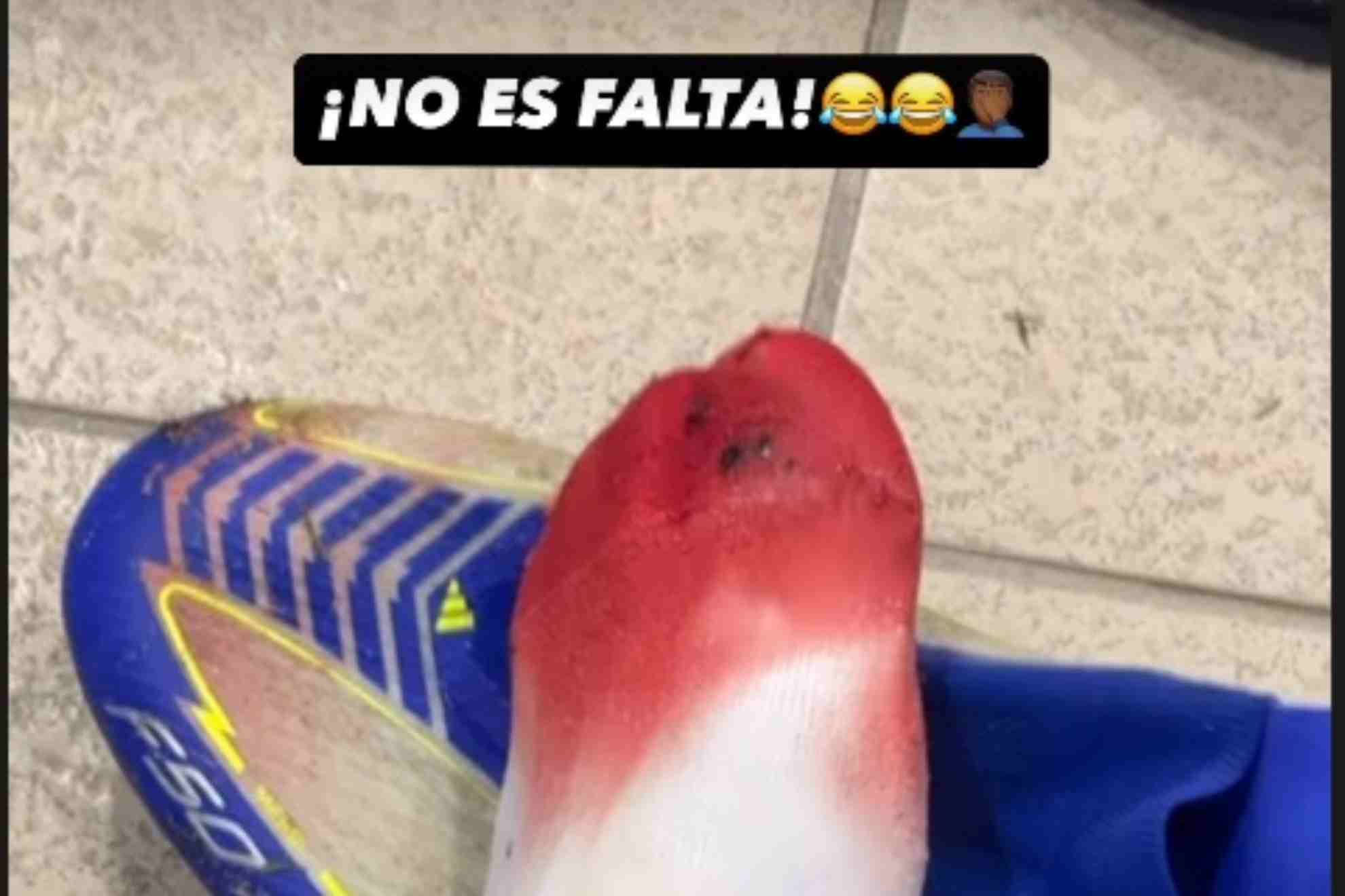 Pie de Ansu Fati