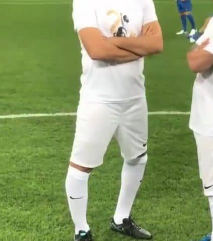 Gianluca Zambrotta, l'ex Barcellona che si fa fuori le gambe: "Li raddrizzeranno tagliando pezzi di osso"