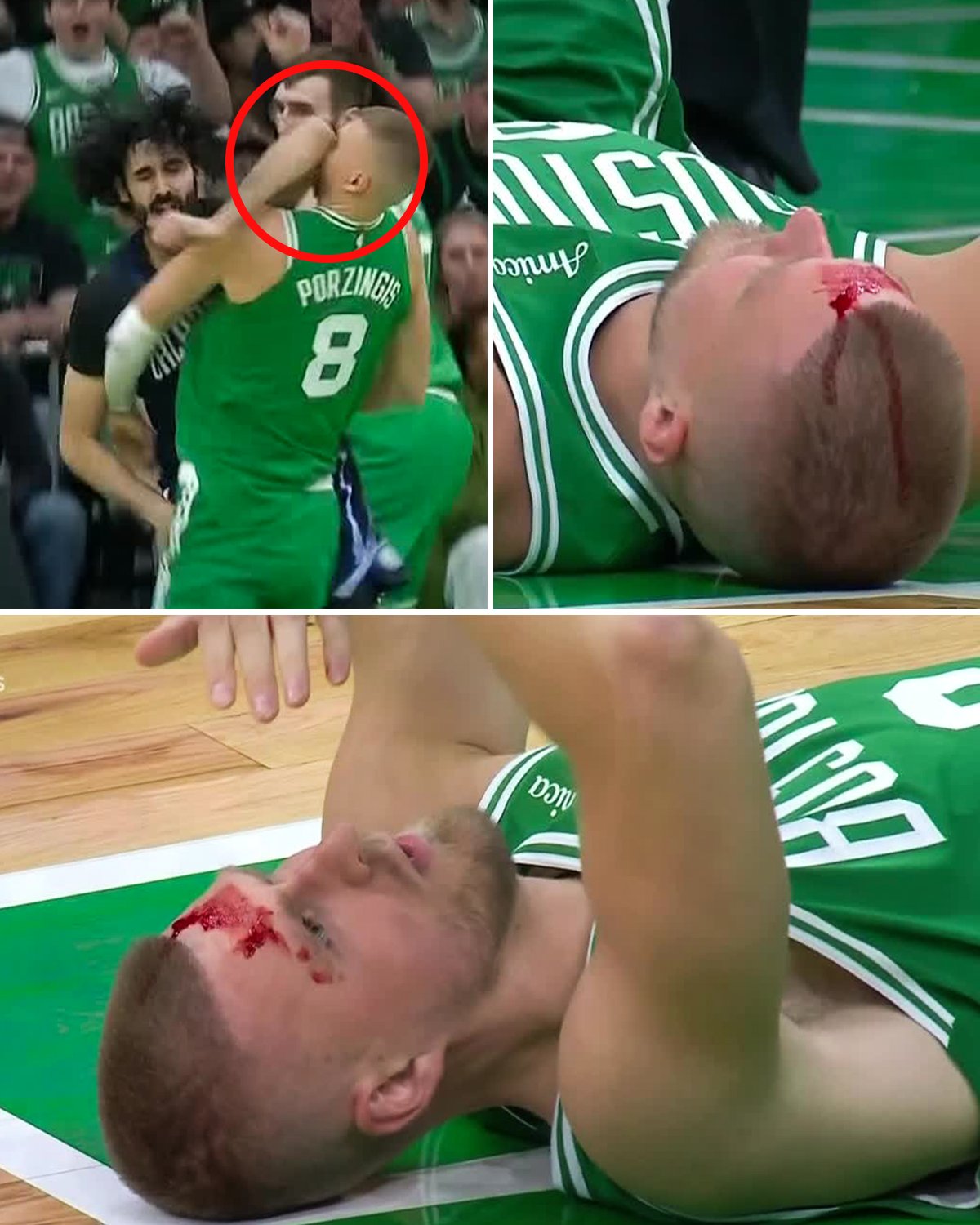 Codazo sangriento de Goga Bitadze a Kristaps Porzingis