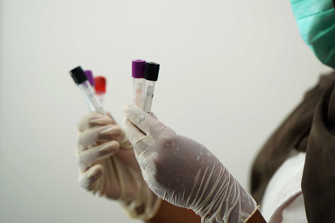 Blood samples